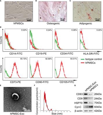 hPMSCs-Derived Exosomal miRNA-21 Protects Against Aging-Related Oxidative Damage of CD4+ T Cells by Targeting the PTEN/PI3K-Nrf2 Axis